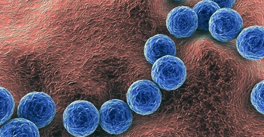 ¿Qué es el Streptococcus pyogenes? Explican cuándo puede complicarse un cuadro infeccioso por esta bacteria