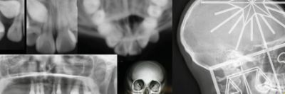 Título de Profesional Especialista en Radiología Dento Máxilo Facial