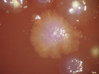 Imágenes de colonias bacterianas 4.