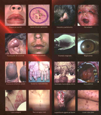 El Dr. Lobos contribuyó con 140 fotografías de alta resolución contenidas en el capítulo Nº 35 del Atlas, el que aborda los estudios sobre la mucosa oral realizados por el académico. 