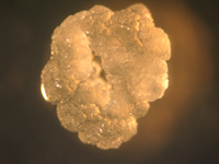 Imagen de una colonia de Streptococcus mutans. 